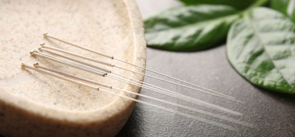 Akupunktura podstawy